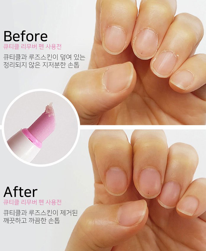 MYHUO Makeup Collection 買貨彩妝 - ECHO TOUCH 死皮擦擦筆  - 2ml