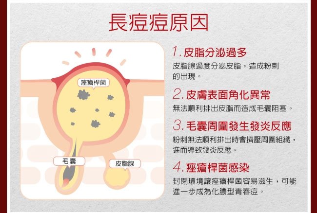 DR.WU 達爾膚 - 杏仁酸淨痘調理精華  - 20ml